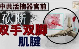 【超短视频】第三集. 中共活摘器官前砍斷四肢肌腱